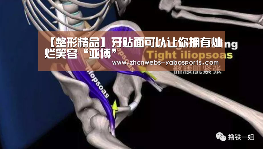 【整形精品】牙贴面可以让你拥有灿烂笑容“亚博”(图1) 亚博官方网站